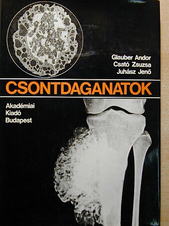 Csató Zsuzsa - Csontdaganatok [antikvár]