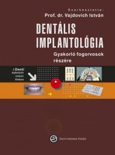 Vajdovich István - Dentális implantológia - Gyakorló fogorvosok részére  [szépséghibás]