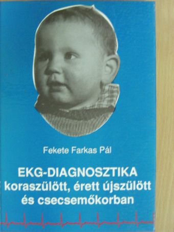 Fekete Farkas Pál - EKG-diagnosztika koraszülött, érett újszülött és csecsemőkorban [antikvár]