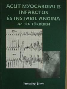 Tomcsányi János - Acut myocardialis infarctus és instabil angina az EKG tükrében [antikvár]