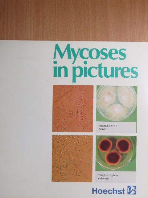 Mycoses in Pictures [antikvár]