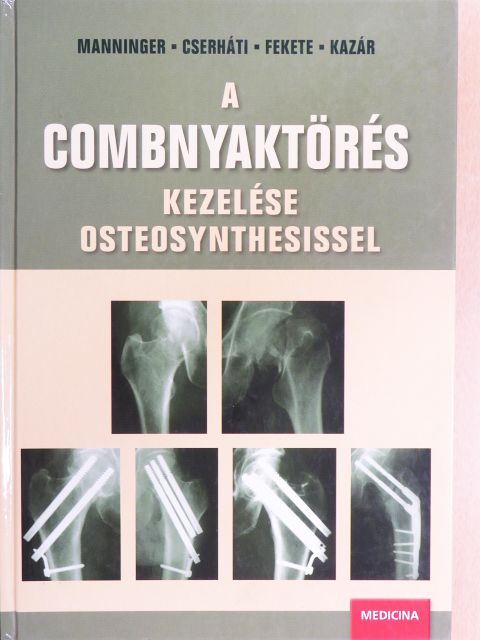 Árva Gábor - A combnyaktörés kezelése osteosynthesissel [antikvár]