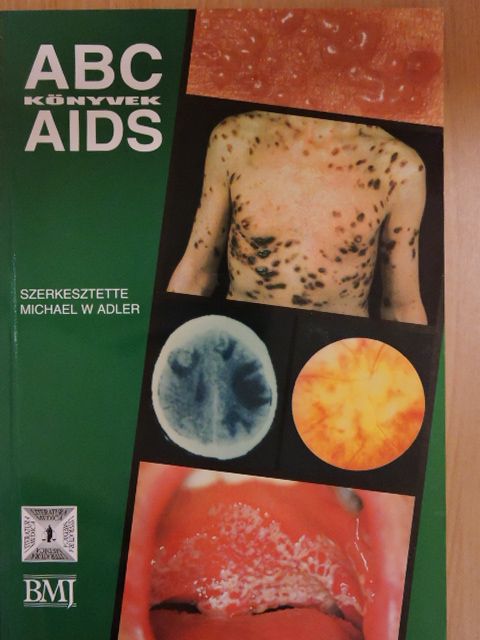 AIDS [antikvár]