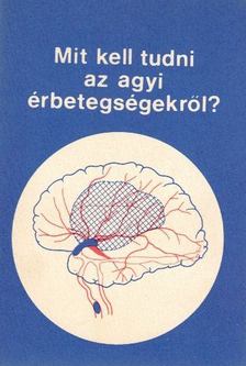Dr. Leel-Őssy Lóránt - Mit kell tudni az agyi érbetegségekről? [antikvár]