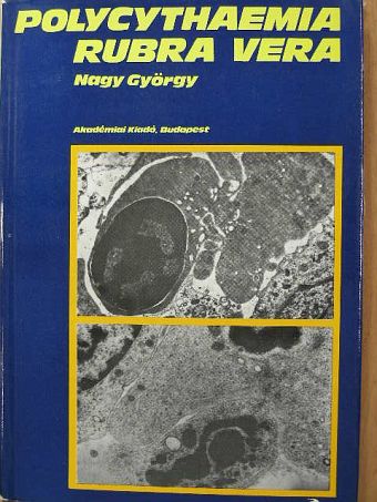 Nagy György - Polycythaemia rubra vera klinikuma, pathologiája és korszerű kezelése [antikvár]