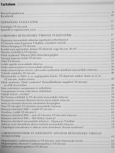 Tomcsányi János - ST-elevatiók [antikvár]