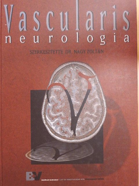 Dr. Bereczki Dániel - Vascularis neurologia [antikvár]