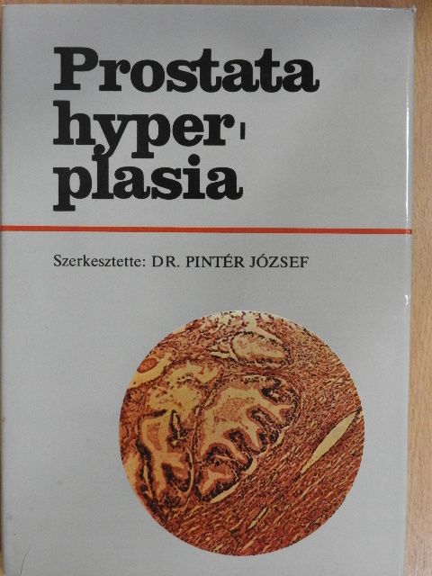 Balogh F. - Prostata hyperplasia [antikvár]