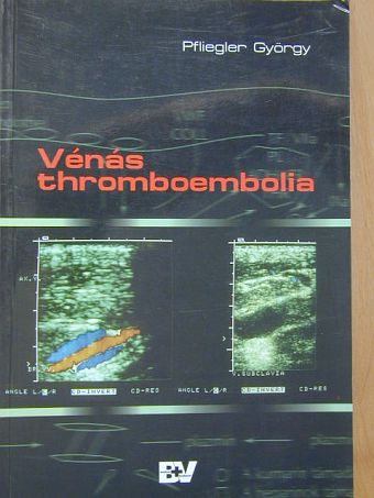 Dr. Pfliegler György - Vénás thromboembolia [antikvár]