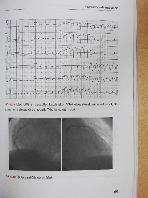 Dr. Arányi József - SpringMed Orvosi esettanulmányok - Kardiológia [antikvár]
