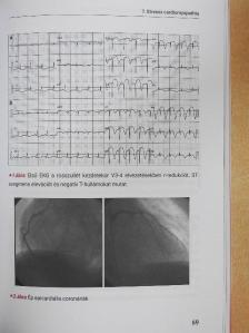 Dr. Arányi József - SpringMed Orvosi esettanulmányok - Kardiológia [antikvár]
