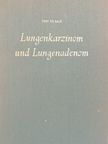 Prof. Dr. Josef Baló - Lungenkarzinom und Lungenadenom [antikvár]