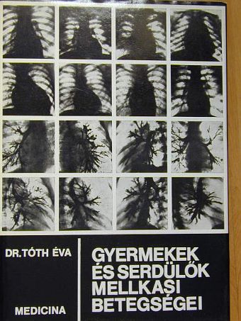 Dr. Tóth Éva - Gyermekek és serdülők mellkasi betegségei [antikvár]