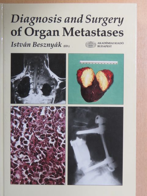 Béla Fornet - Diagnosis and Surgery of Organ Metastases [antikvár]