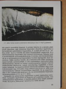 Dr. Bánóczy Jolán - Preventív fogászat [antikvár]