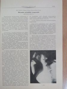 Dr. Bartosiewicz Gábor - Rheumás styloiditis temporalis [antikvár]