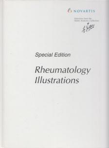 Frank H. Netter - Rheumatology [antikvár]