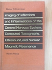 Dieter R. Enzmann - Imaging of Infections and Inflammations of the Central Nervous System: Computed Tomography, Ultrasound, and Nuclear Magnetic Resonance [antikvár]
