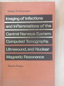 Dieter R. Enzmann - Imaging of Infections and Inflammations of the Central Nervous System: Computed Tomography, Ultrasound, and Nuclear Magnetic Resonance [antikvár]