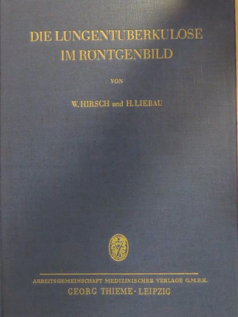 Dr. Helmut Liebau - Die Lungentuberkulose im Röntgenbild [antikvár]