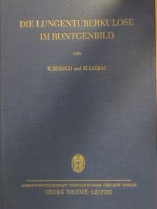 Dr. Helmut Liebau - Die Lungentuberkulose im Röntgenbild [antikvár]