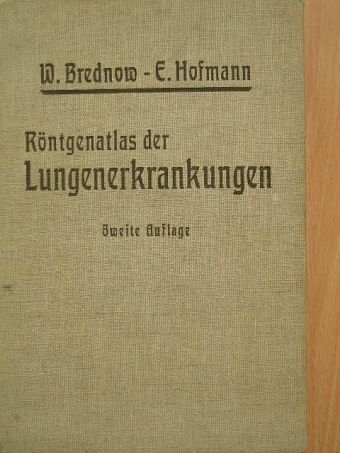 Dr. E. Hofmann - Röntgenatlas der Lungenerkrankungen [antikvár]
