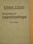 Dr. E. Hofmann - Röntgenatlas der Lungenerkrankungen [antikvár]