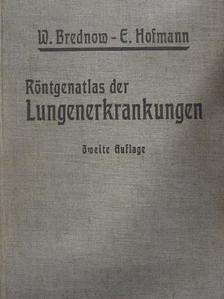 Dr. E. Hofmann - Röntgenatlas der Lungenerkrankungen [antikvár]