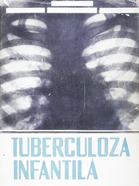 Ana Olariu - Tuberculoza Infantila [antikvár]