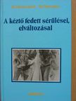 Dr. Glanz János - A kéztő fedett sérülései, elváltozásai [antikvár]