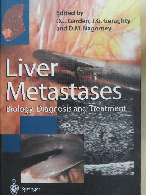 D. M. Nagorney - Liver Metastases [antikvár]