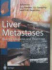 D. M. Nagorney - Liver Metastases [antikvár]