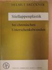 Dr. Peter Pietsch - Stiellappenplastik bei chronischen Unterschenkelwunden [antikvár]