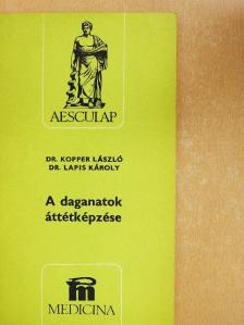 Dr. Kopper László - A daganatok áttétképzése [antikvár]