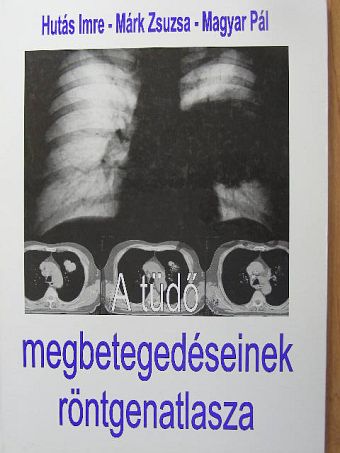 Hutás Imre - A tüdő megbetegedéseinek röntgenatlasza [antikvár]