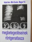 Hutás Imre - A tüdő megbetegedéseinek röntgenatlasza [antikvár]