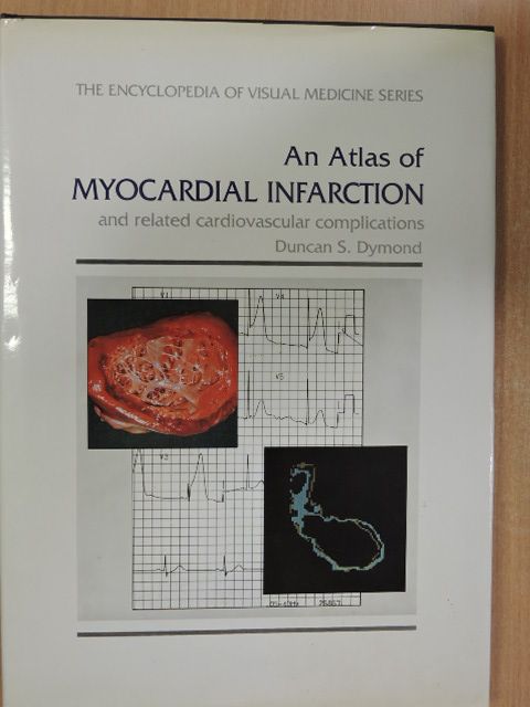 Duncan S. Dymond - An Atlas of Myocardial Infarction and related cardiovascular complications [antikvár]