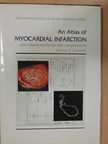 Duncan S. Dymond - An Atlas of Myocardial Infarction and related cardiovascular complications [antikvár]