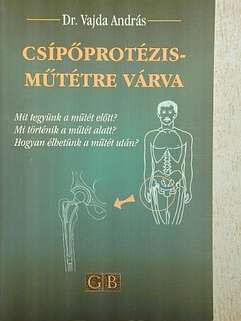 Dr. Vajda András - Csípőprotézis-műtétre várva [antikvár]