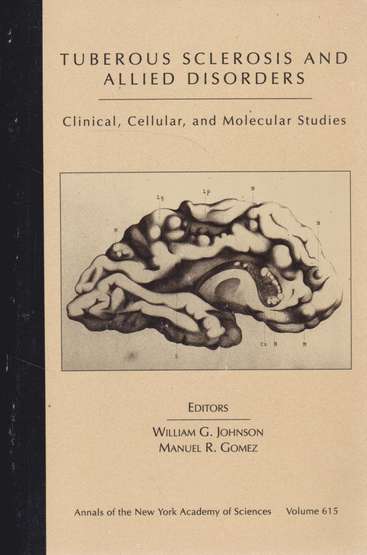 Johnson, William G, Gomez, Manuel R. - Tuberous Sclerosis and Allied Disorders: Clinical, Cellular, and Molecular Studies [antikvár]