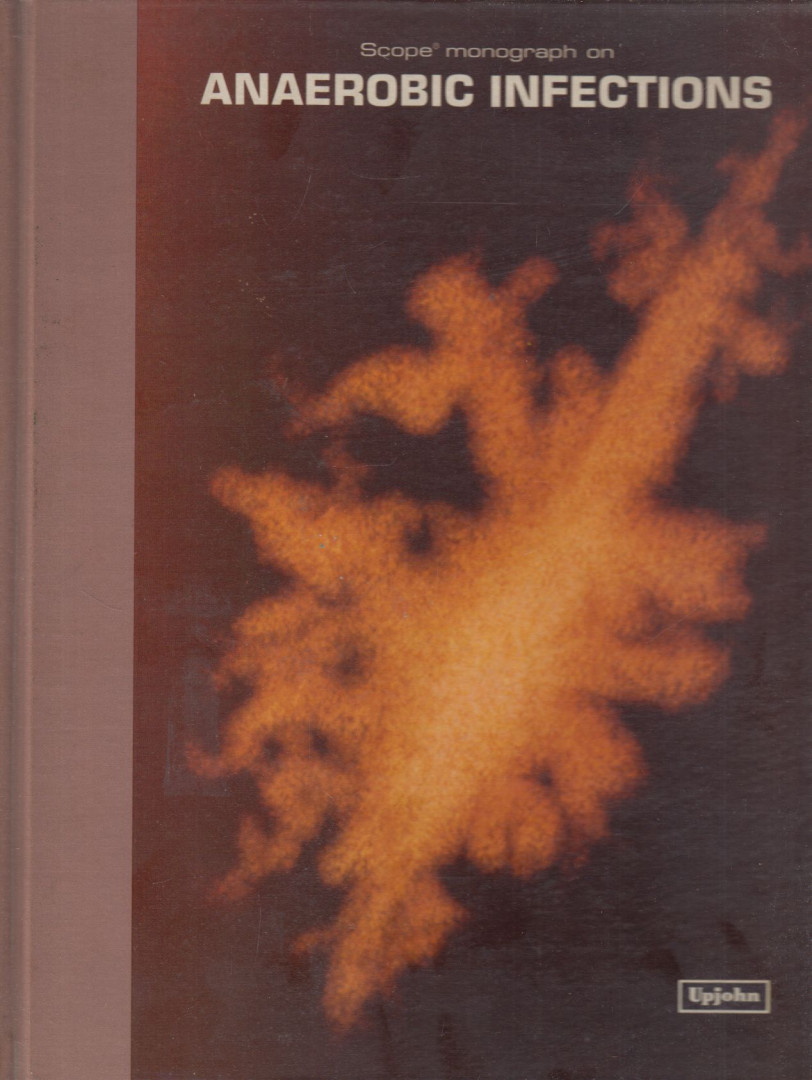 Sydney M. Finegold, M.D. - Scope monograph on Anaerobic infections [antikvár]