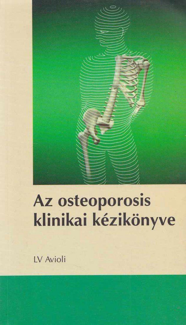 Avioli, LV - Az osteoporosis klinikai kézikönyve [antikvár]