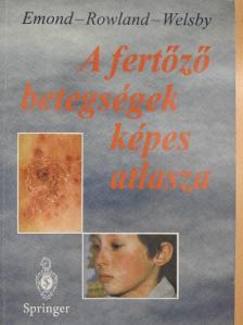Emond - A fertőző betegségek képes atlasza [antikvár]