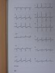 Kékes Ede - EKG atlasz [antikvár]