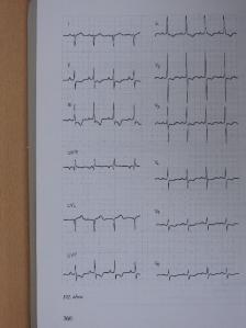 Kékes Ede - EKG atlasz [antikvár]