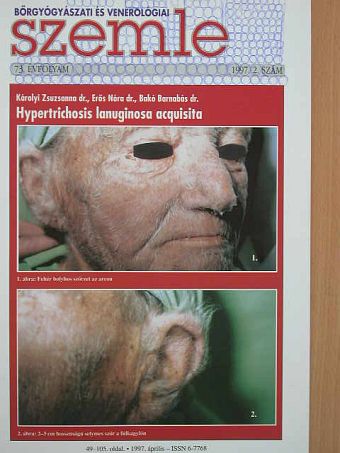 Barabás Éva - Bőrgyógyászati és venerológiai szemle 1997. április [antikvár]