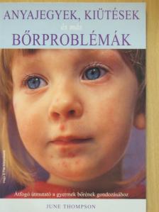 June Thompson - Anyajegyek, kiütések és más bőrproblémák [antikvár]
