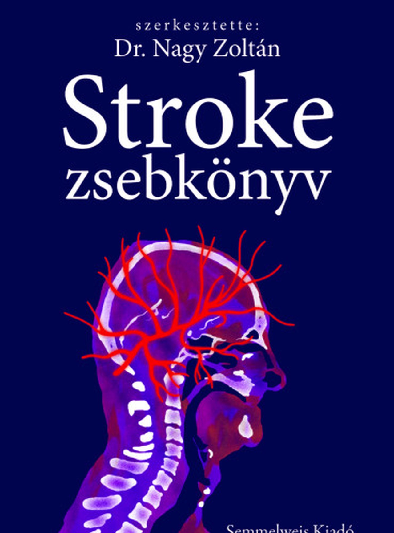 Dr.Nagy Zoltán[szerk.] - Stroke zsebkönyv