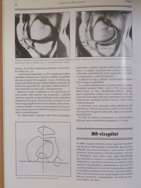 Dr. Balogh Endre - Osteologiai Közlemények 1996. május [antikvár]