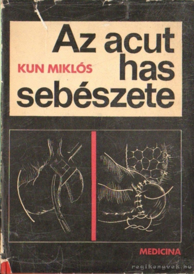 Kun Miklós - Az acut has sebészete [antikvár]